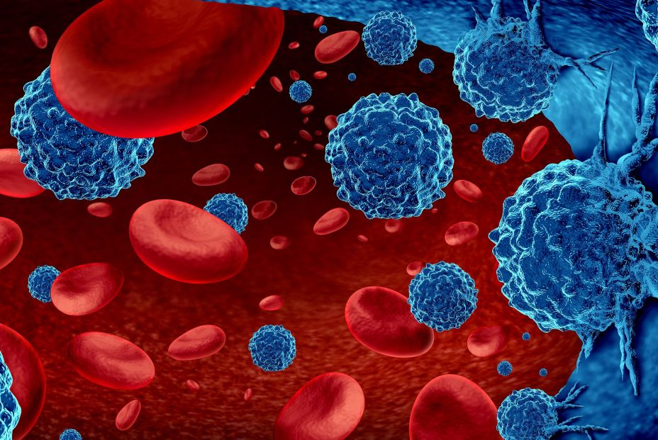 bigstock Cancer In The Blood Outbreak A 409403281 bigstock Cancer In The Blood Outbreak A 409403281