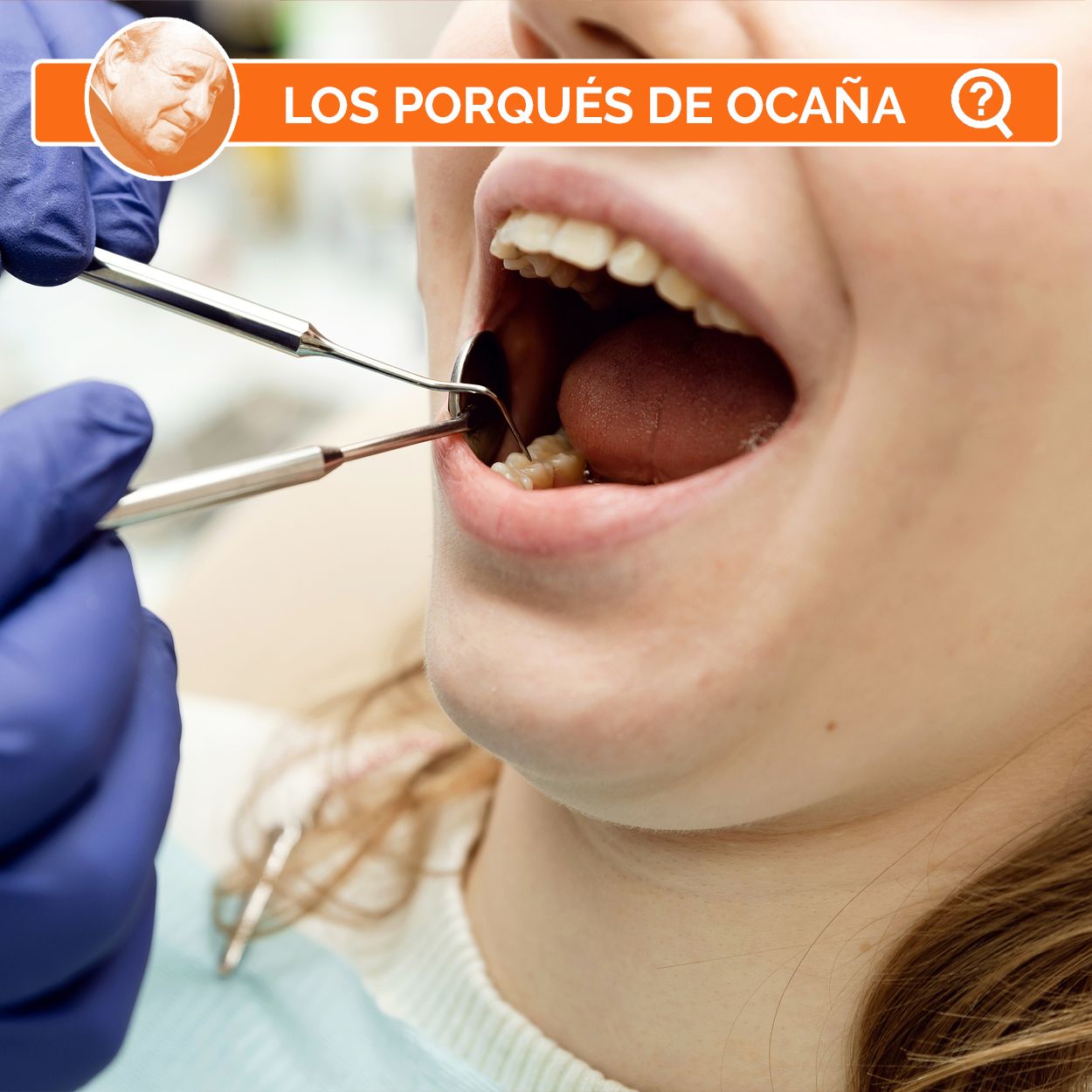 ¿Por qué se produce una caries?