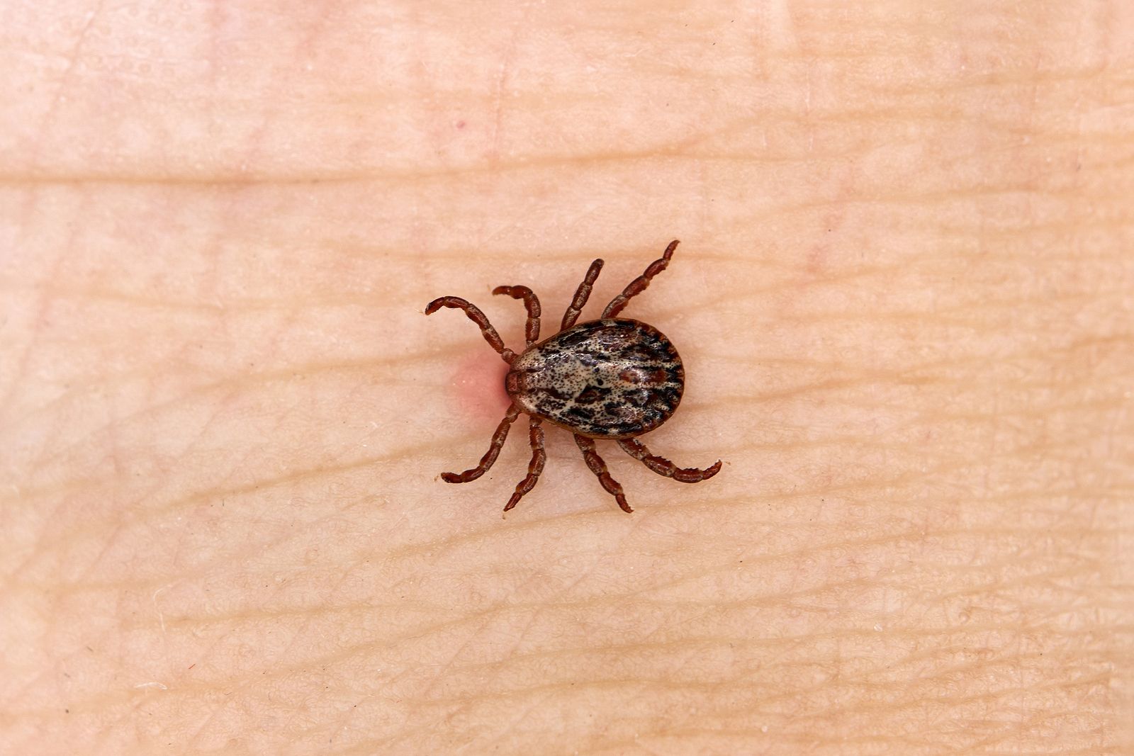 Aumentan los casos de Lyme, una patología emergente causada por garrapatas