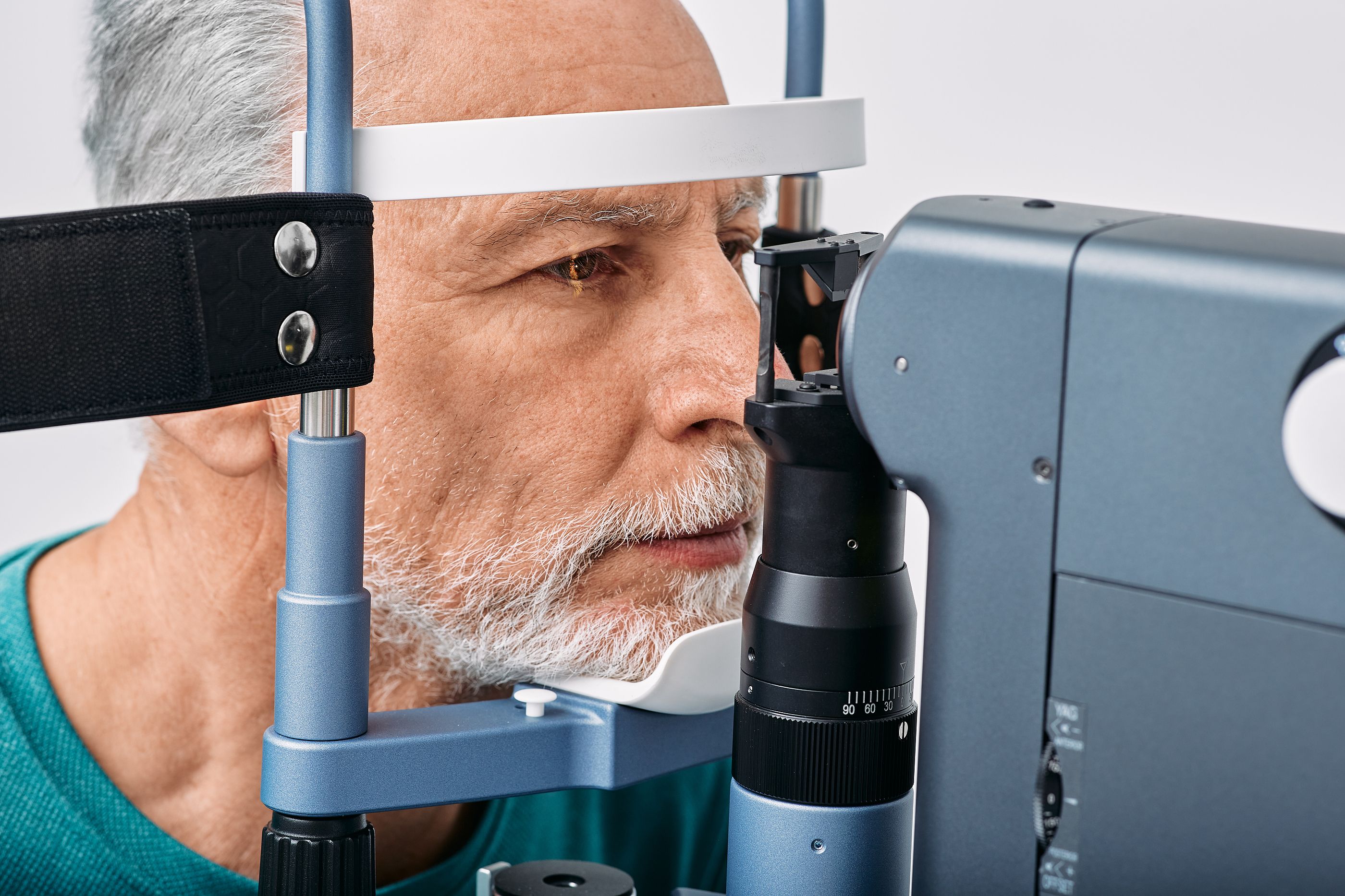 Cambios en la retina que podrían suponer la aparición de alzhéimer