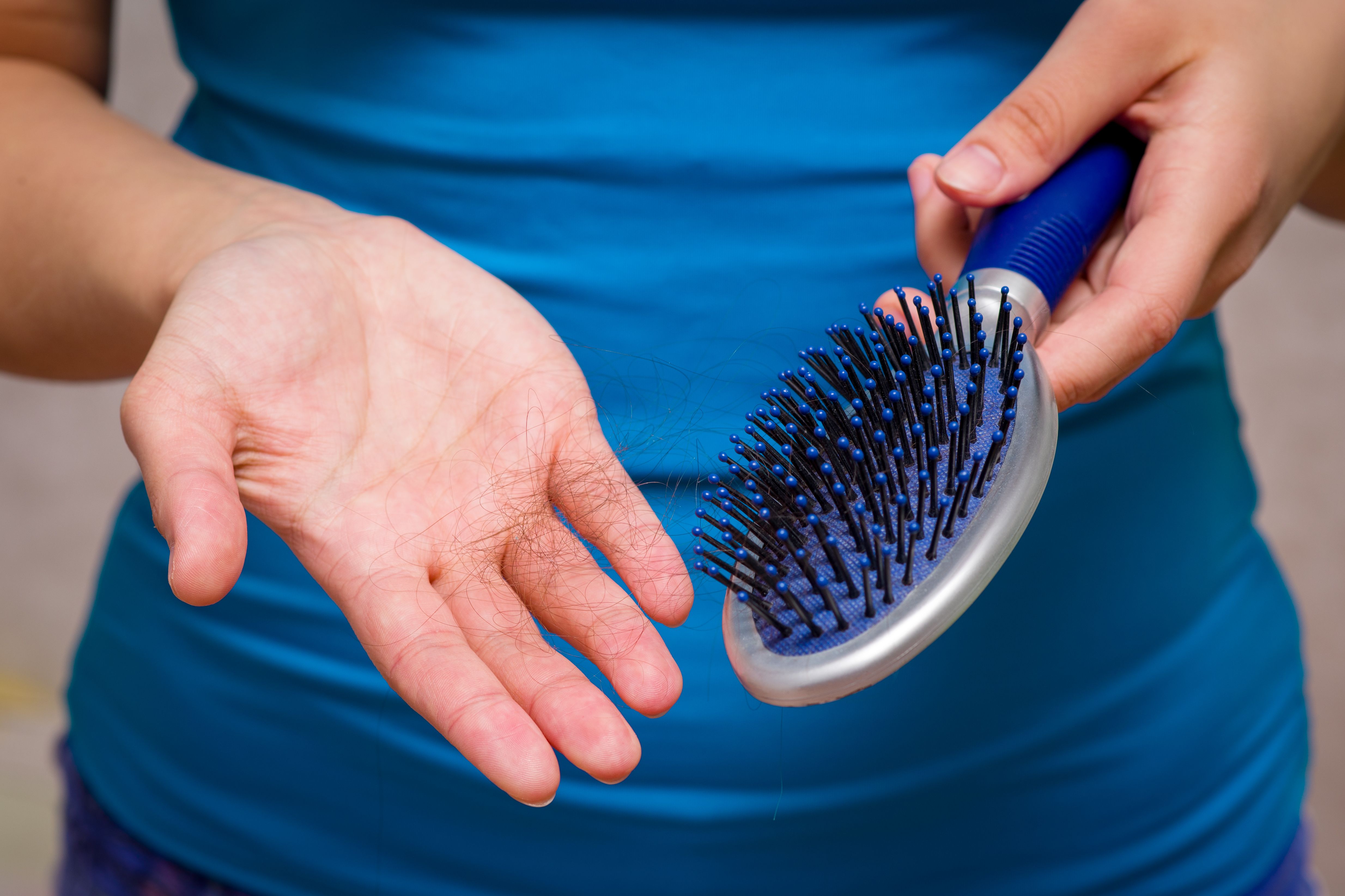  Frenar la pérdida de cabello (bigstock)