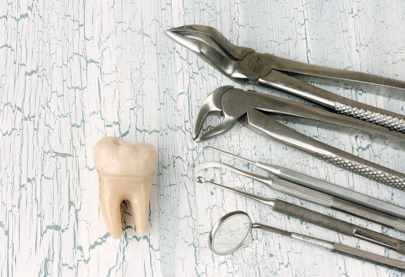 ¿Qué es y cómo se hace un curetaje dental?