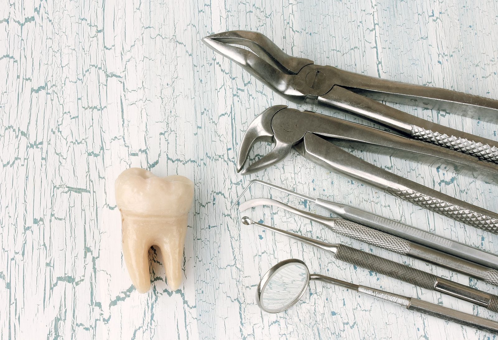 ¿Qué es y cómo se hace un curetaje dental? ¿Qué es y cómo se hace un curetaje dental?
