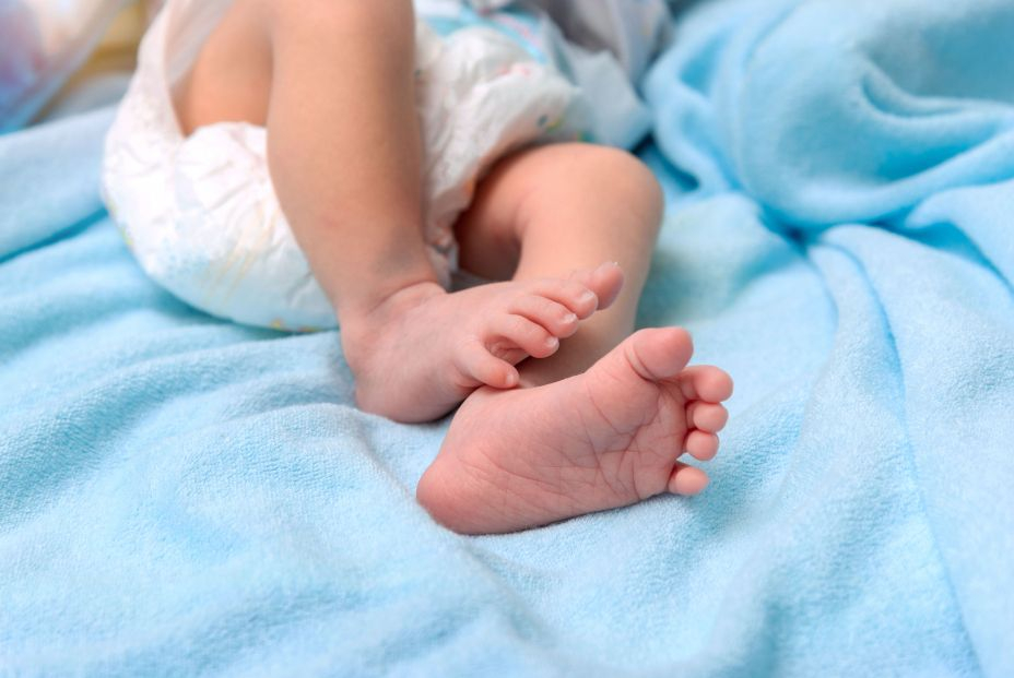 Muere un bebé con ictiosis congénita severa,a las dos horas de nacer sus padres son hermanos