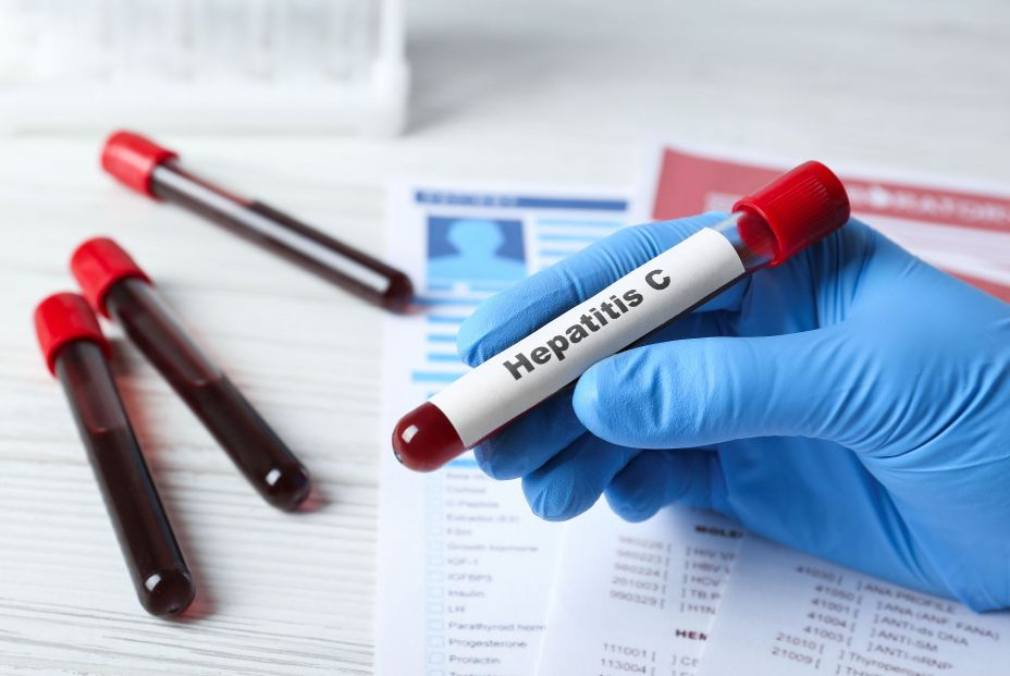 El aviso de un experto sobre las cifras de contagiados de Hepatitis D en España 