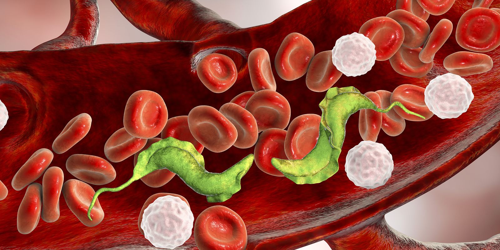 ¿En qué consiste la enfermedad de Chagas?