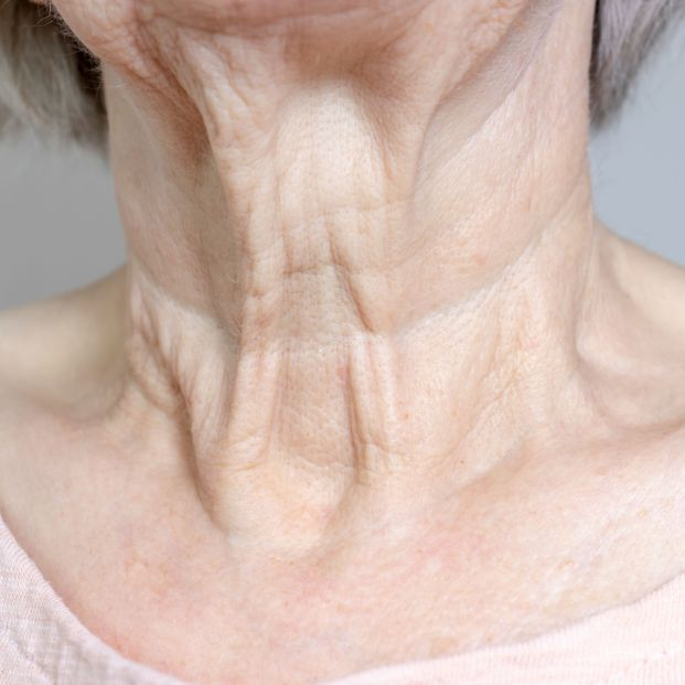 Estas son las razones por las que el cuello envejece más rápido Estas son las razones por las que el cuello envejece más rápido