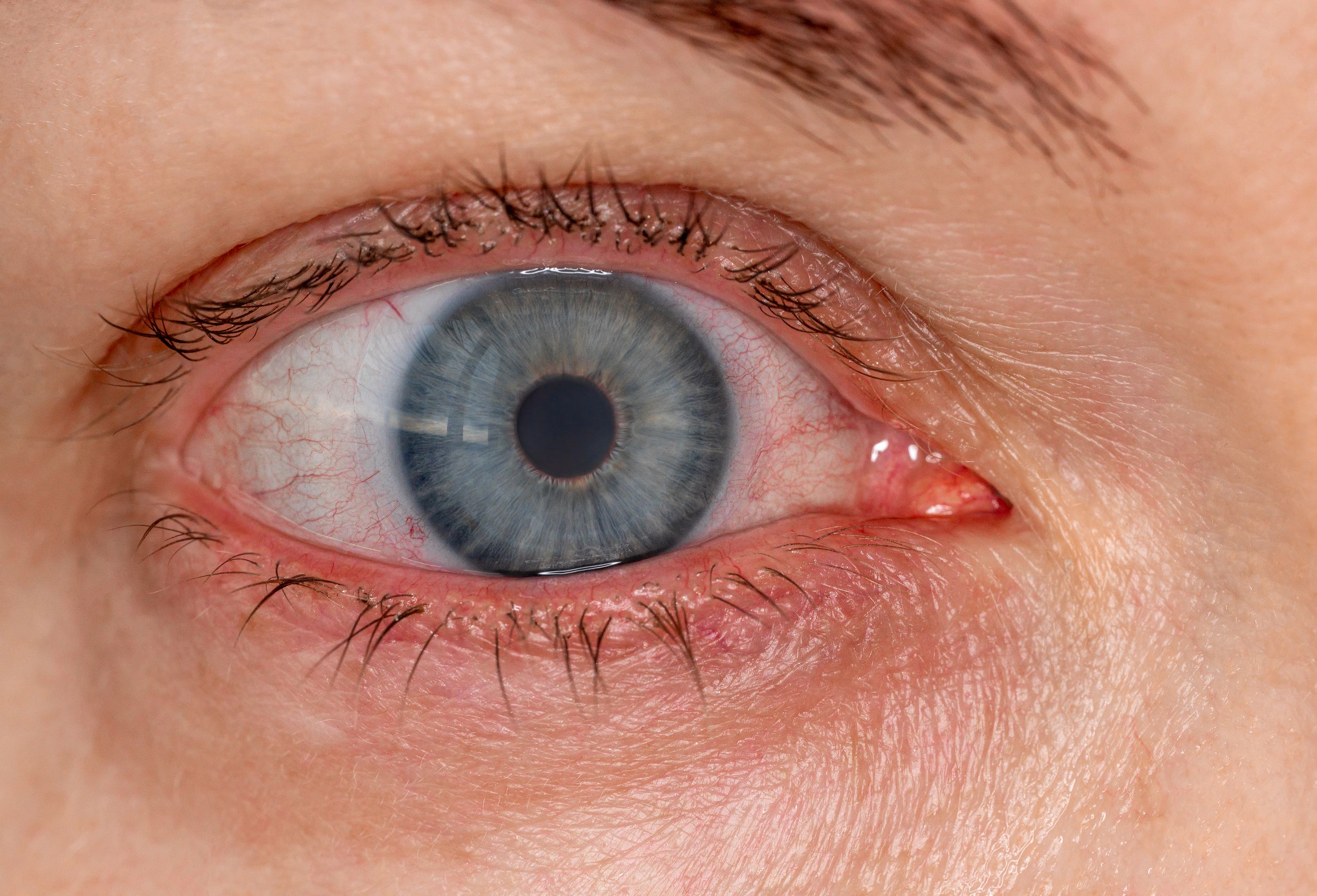 Descubren que no todos los ojos perciben con igual intensidad un mismo objeto