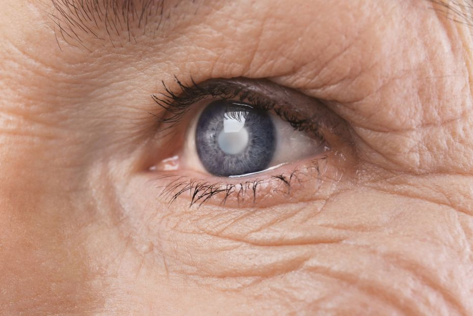 Presbicia, cataratas o degeneración macular... principales problemas de visión con el envejecimiento. Foto: Bigstock