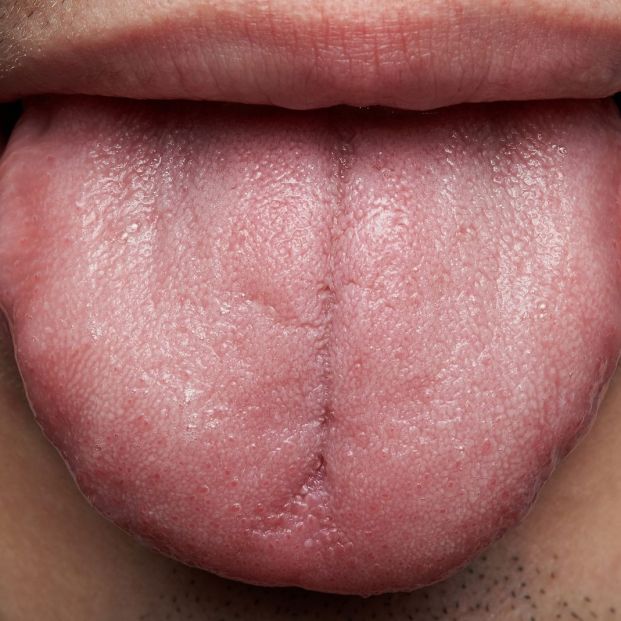 Lengua Lengua