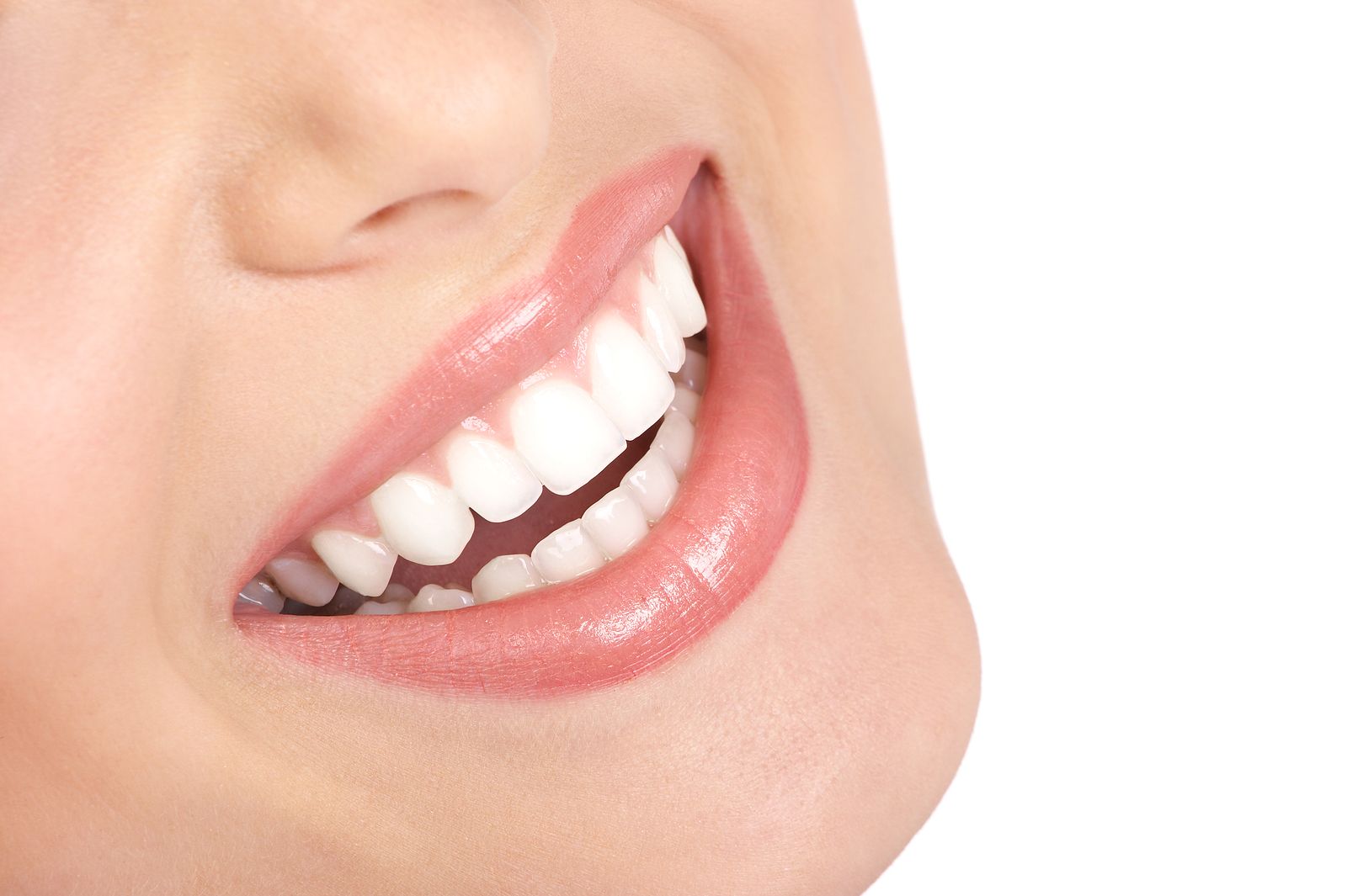 ¿Cuál es el precio de los brackets y cuál es la mejor alternativa? Foto: bigstock ¿Cuál es el precio de los brackets y cuál es la mejor alternativa? Foto: bigstock