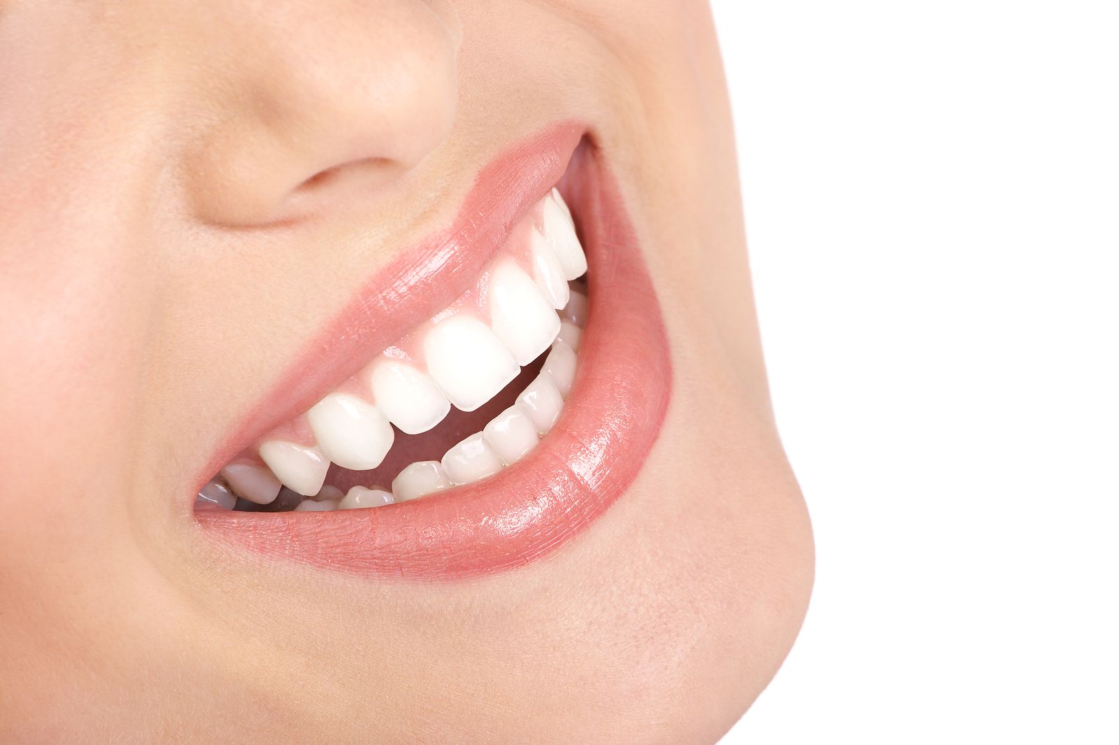 ¿Cuál es el precio de los brackets y cuál es la mejor alternativa? Foto: bigstock