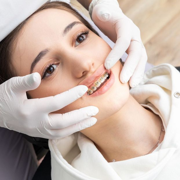 ¿Cuál es el precio de los brackets y cuál es la mejor alternativa? Foto: bigstock ¿Cuál es el precio de los brackets y cuál es la mejor alternativa? Foto: bigstock