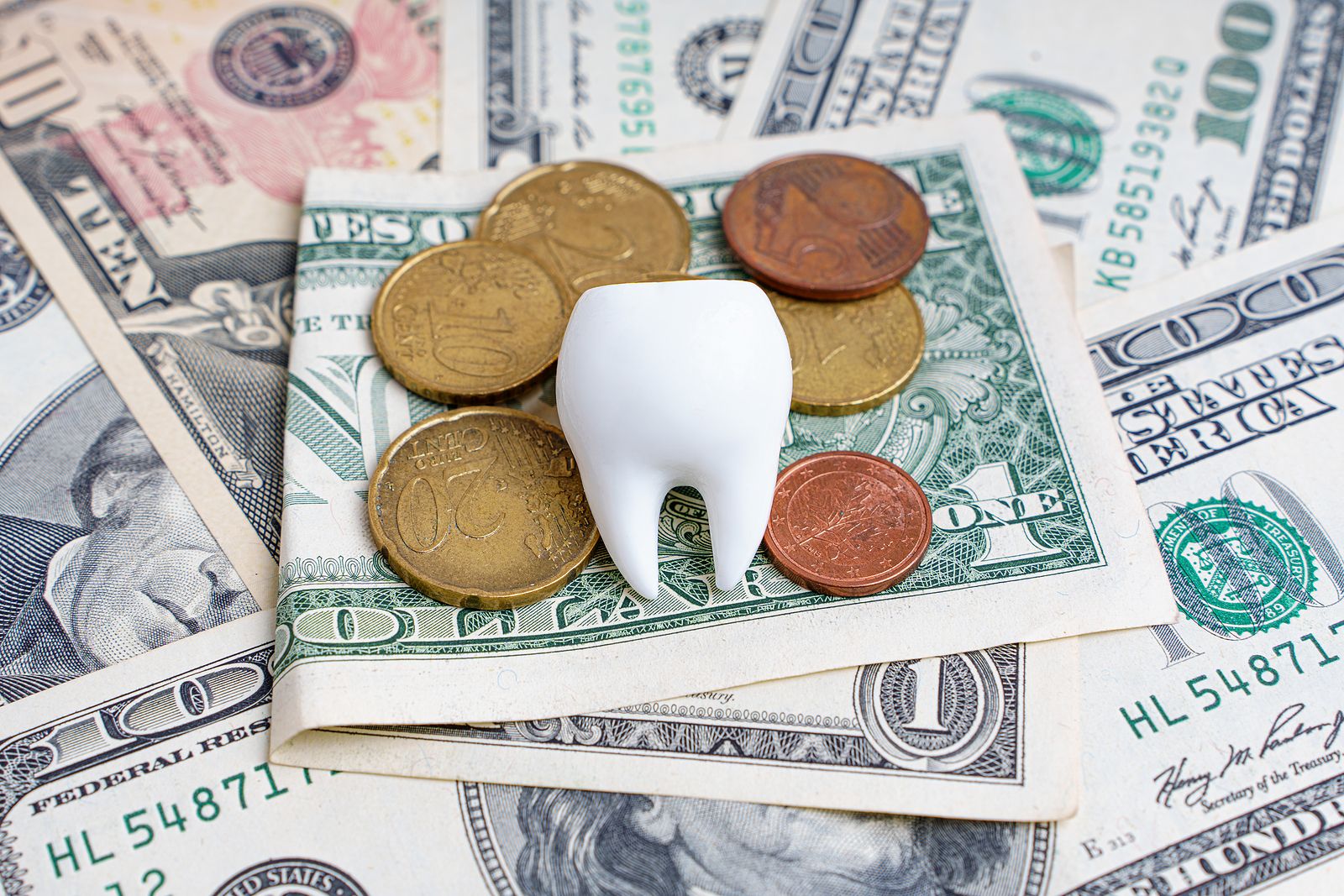 Cuando ir al dentista es un lujo: casi el 100% del gasto en España sale del bolsillo del ciudadano