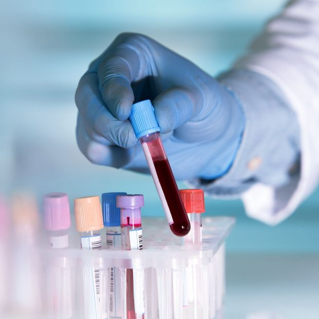 Un nuevo análisis de sangre es capaz de detectar más del 80% de los cánceres de hígado. Foto: Bigstock