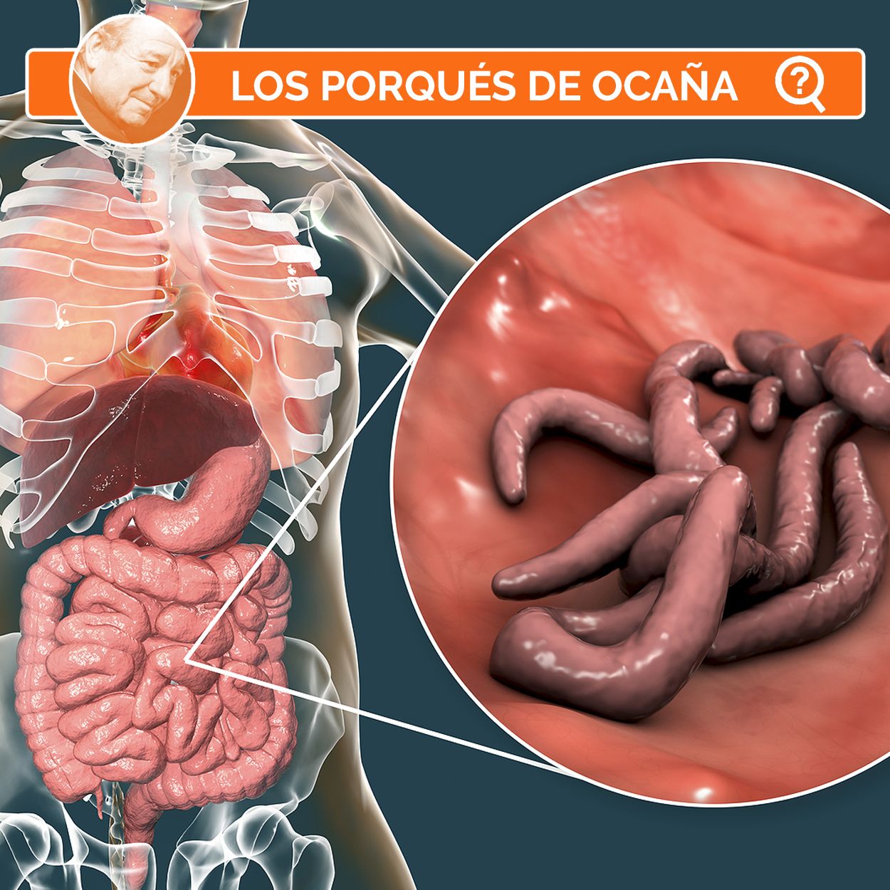 ¿Por qué están volviendo las lombrices?