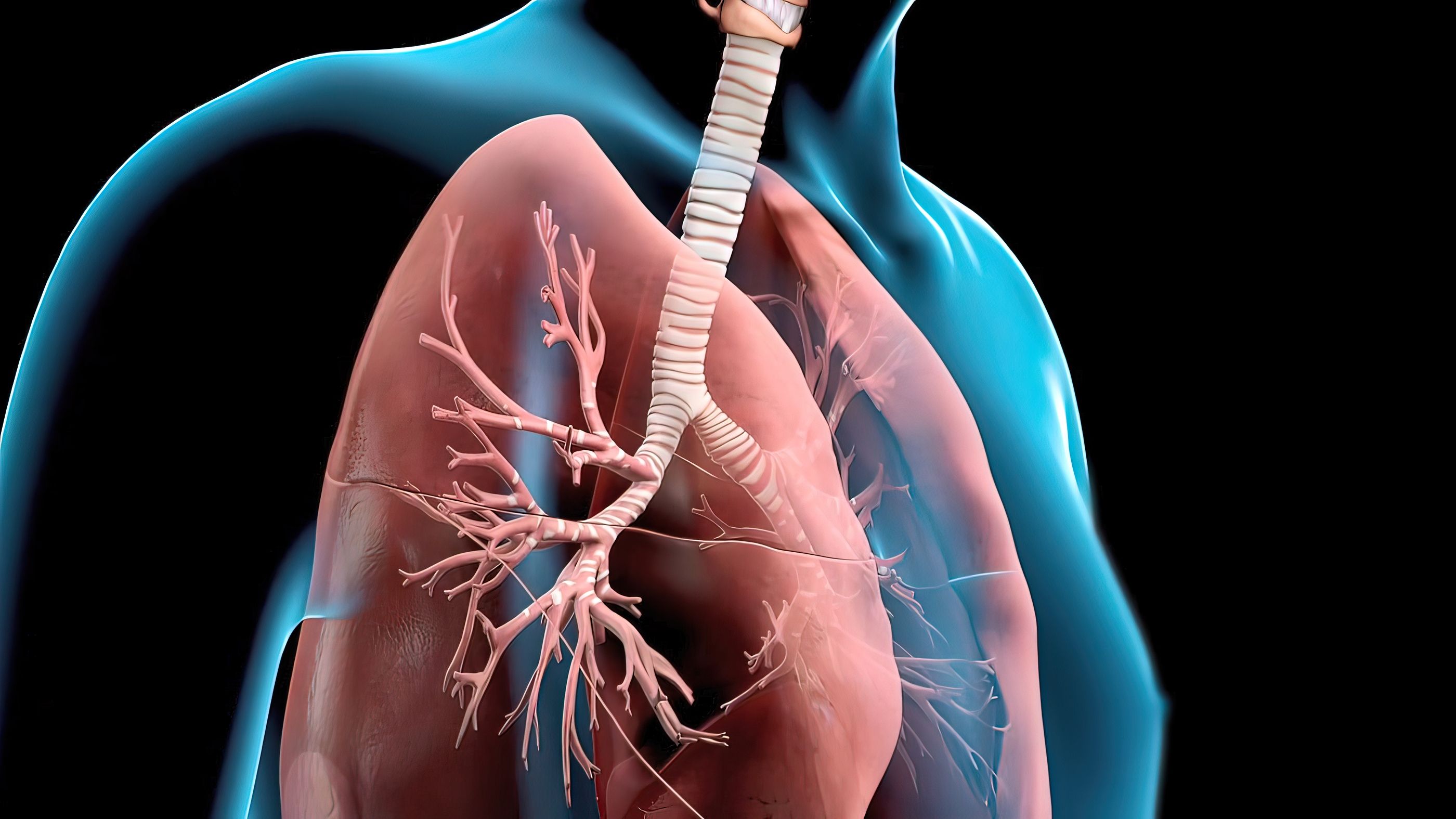 Qué diferencia hay entre bronquitis y bronquiolitis