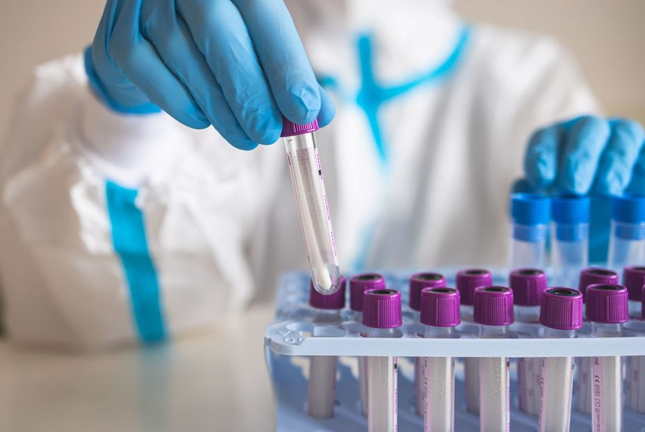 bigstock Process Of Coronavirus Pcr Ant 450387277