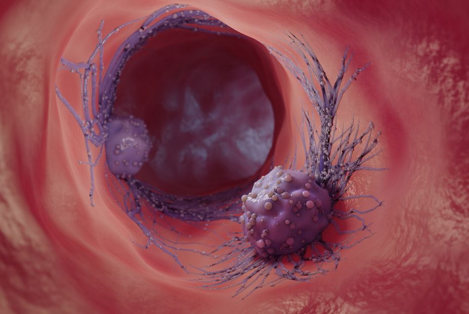 bigstock  d Illustration Of A Cancer Ce 454825019