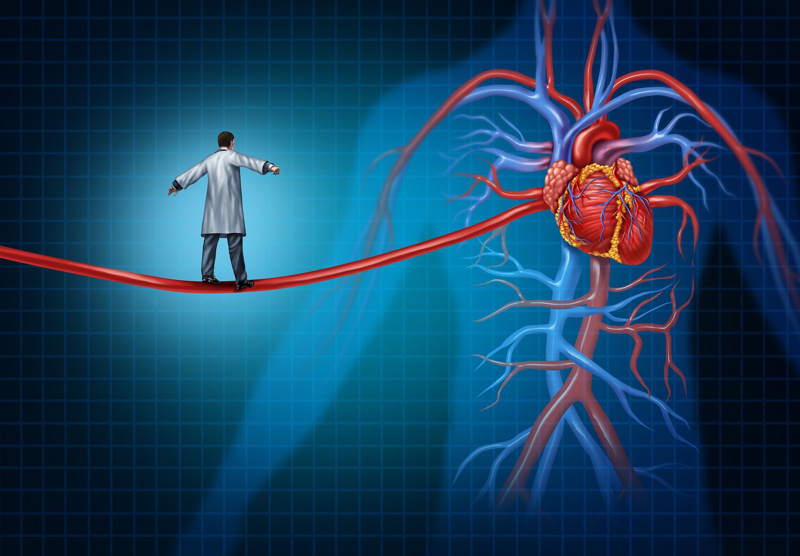 Cardiopatías: ¿qué sabes sobre el bypass coronario?