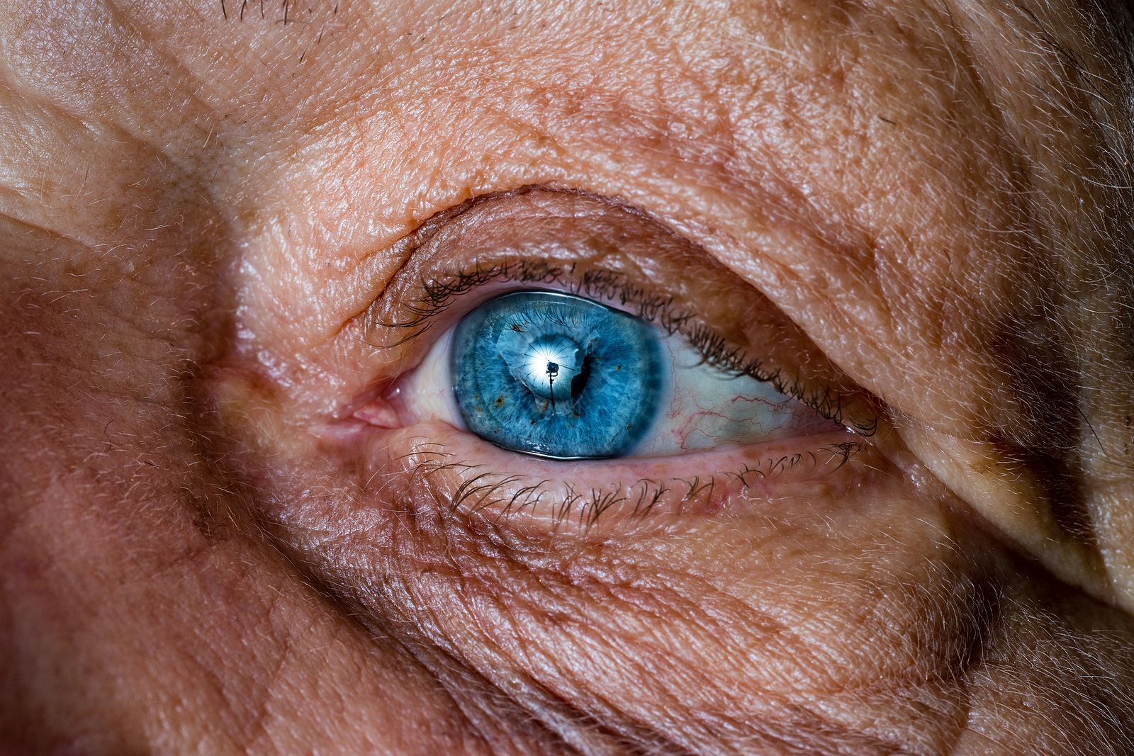 ¿Por qué es blanco el blanco de los ojos?