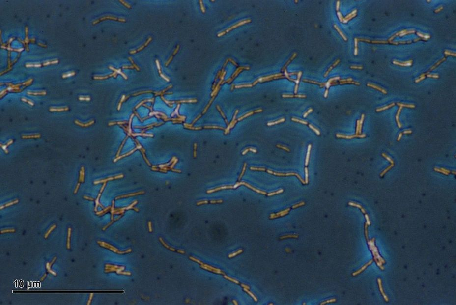 EuropaPress 3516930 imagen microscopio lactobacilus acidophilus bacteria sido empleada llevar