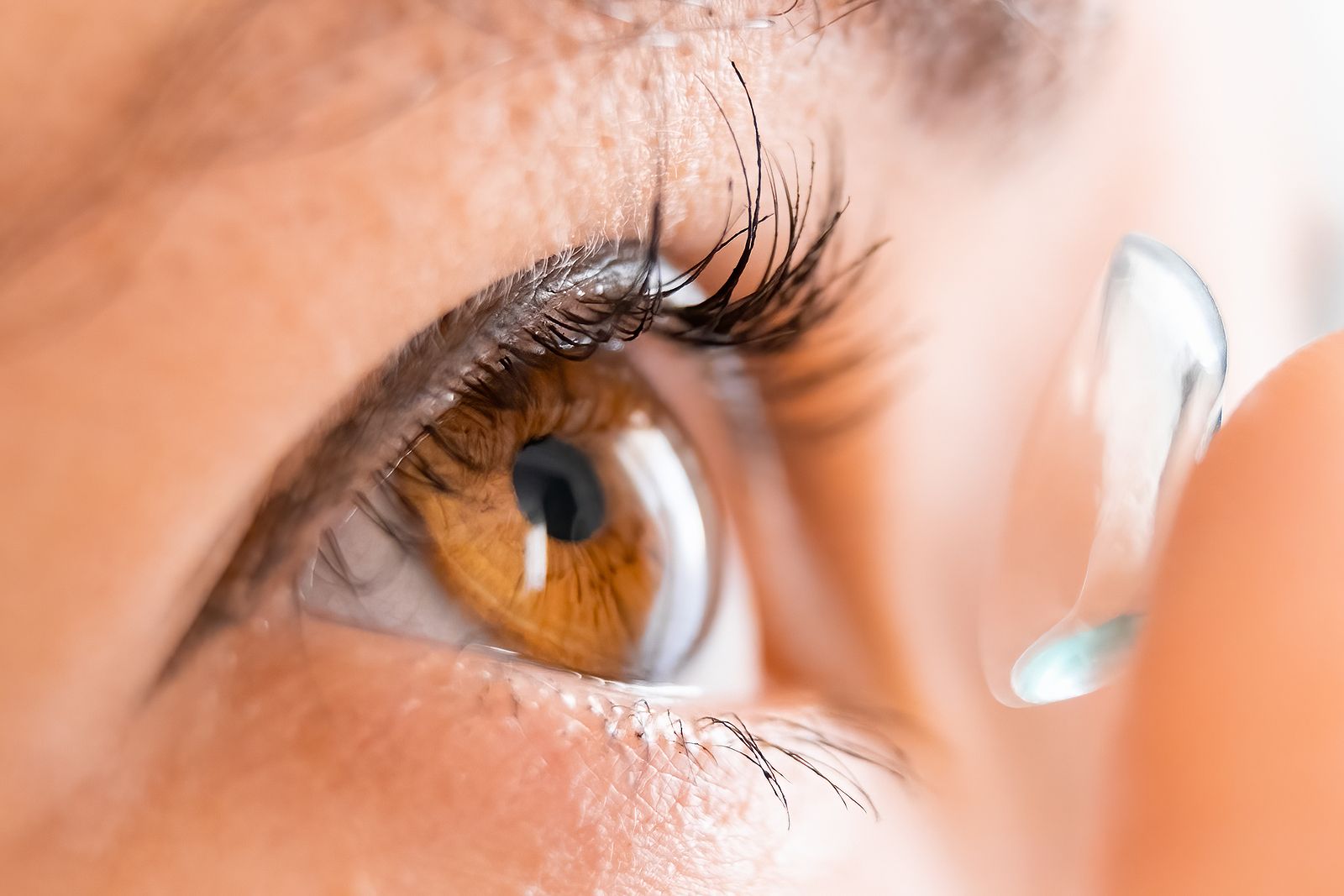 Oro para diagnosticar una patología ocular asociada al mal uso de lentillas
