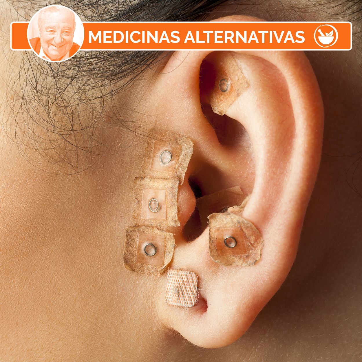 Auriculoterapia: qué es y para qué se utiliza