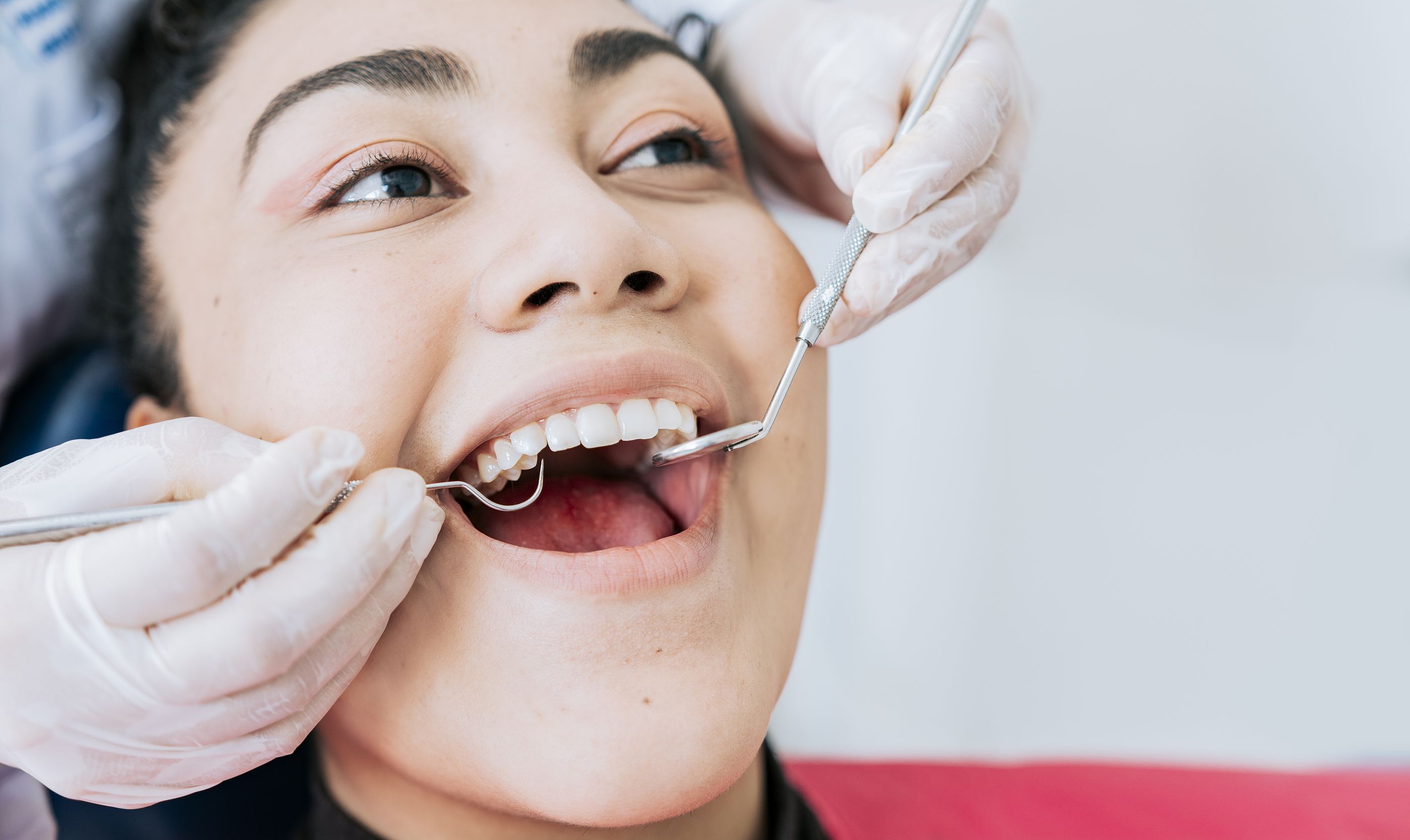 Identifican qué bacterias de las encías anticipan el riesgo de padecer periodontitis