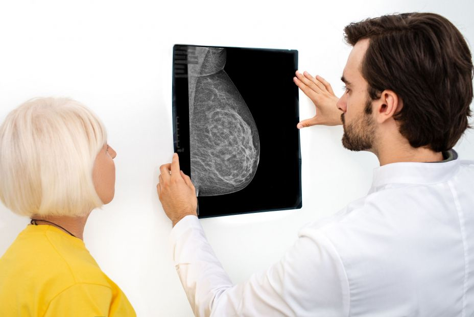bigstock Mammogram Film Image Of A Fema 384558935