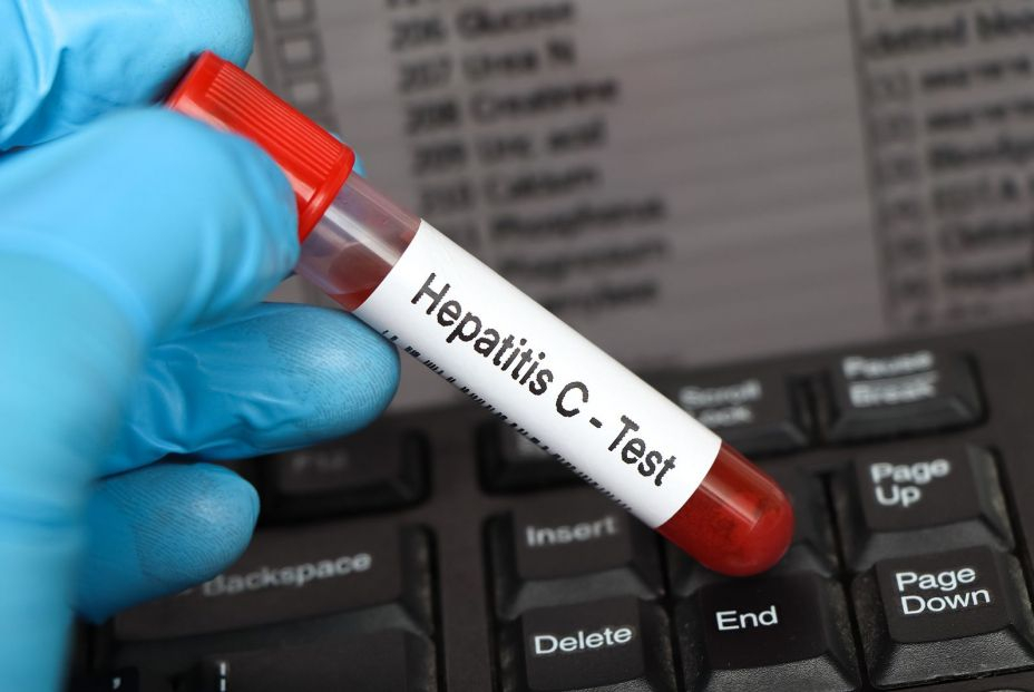 Descubren una prueba más sencilla, rápida y barata para detectar la hepatitis C Descubren una prueba más sencilla, rápida y barata para detectar la hepatitis C