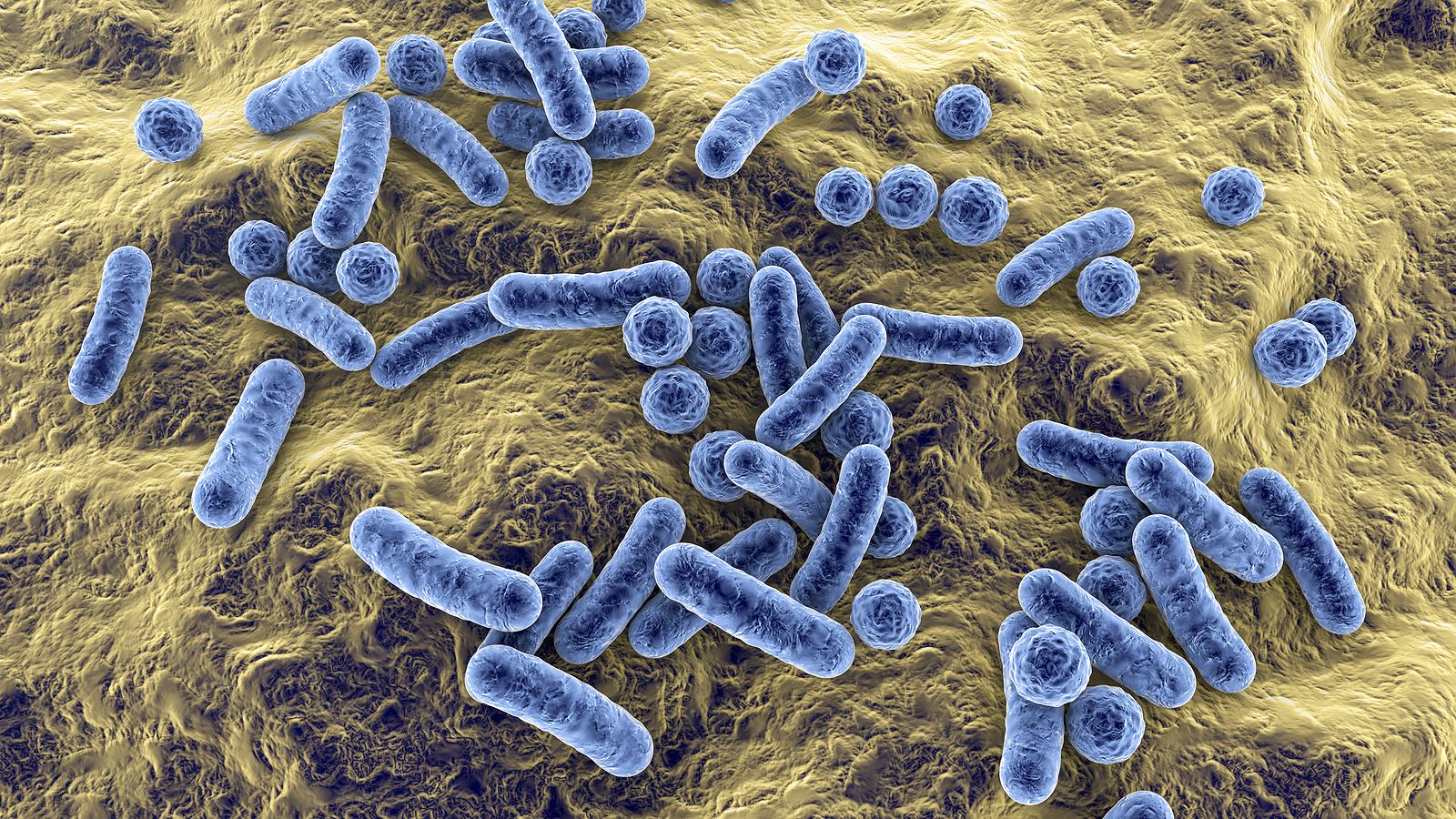 Descubren que el Covid ha modificado una bacteria multirresistente que causa neumonía y sepsis