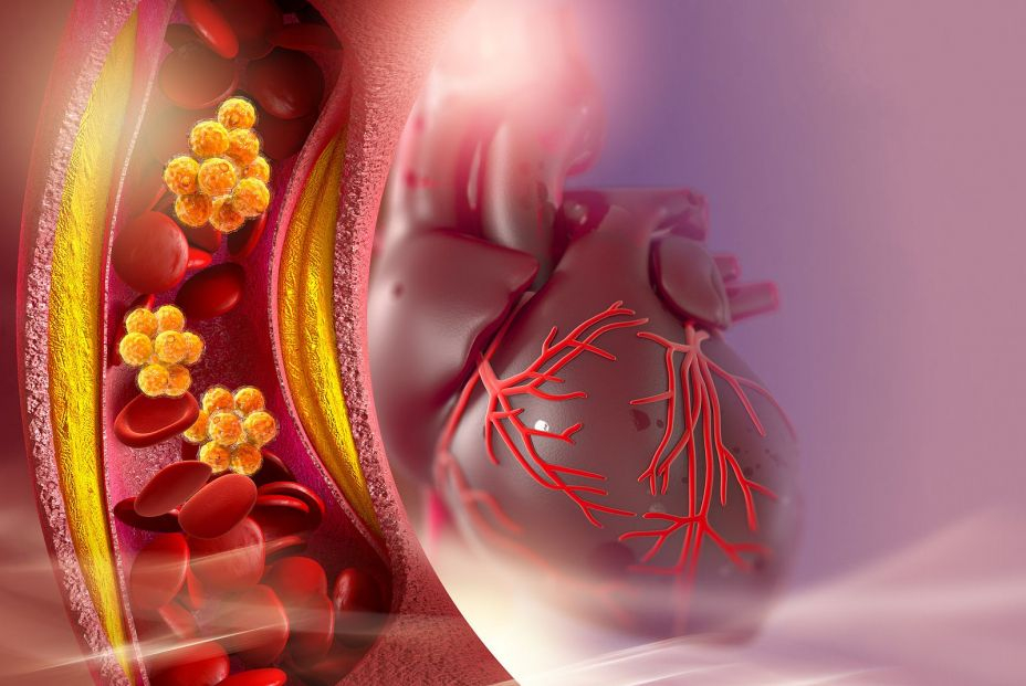 El colesterol afecta al corazón