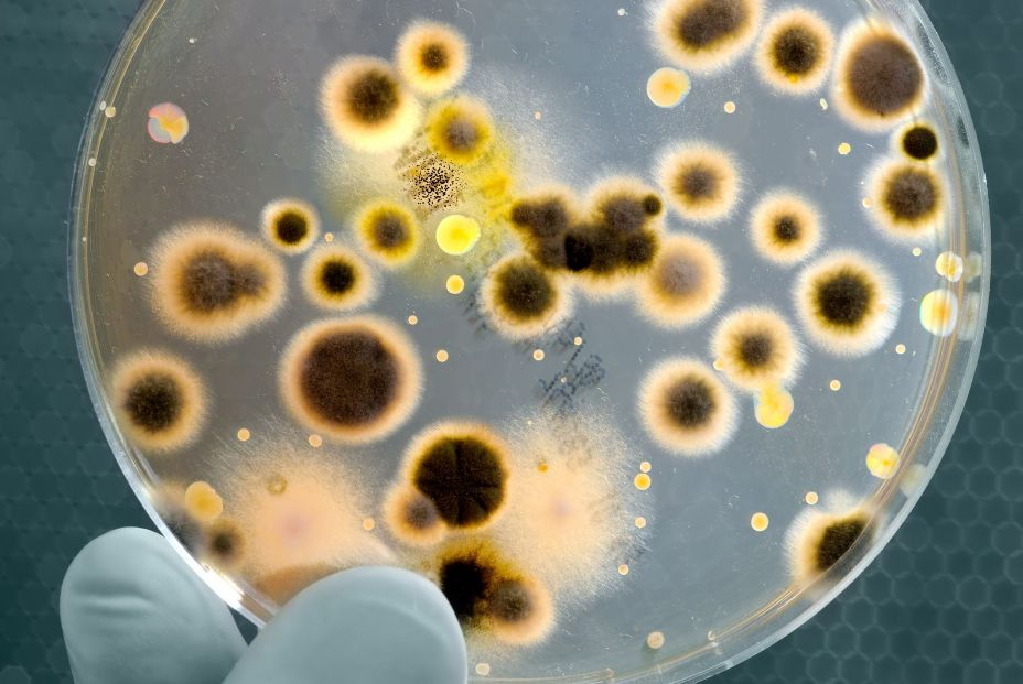 bigstock Petri dish with bacteria 5710019