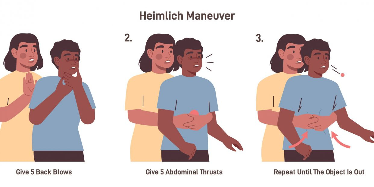 Esta es una breve explicación de la maniobra de Heimlich