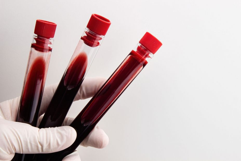 Identifican biomarcadores en la sangre para predecir precozmente el deterioro cognitivo en mayores
