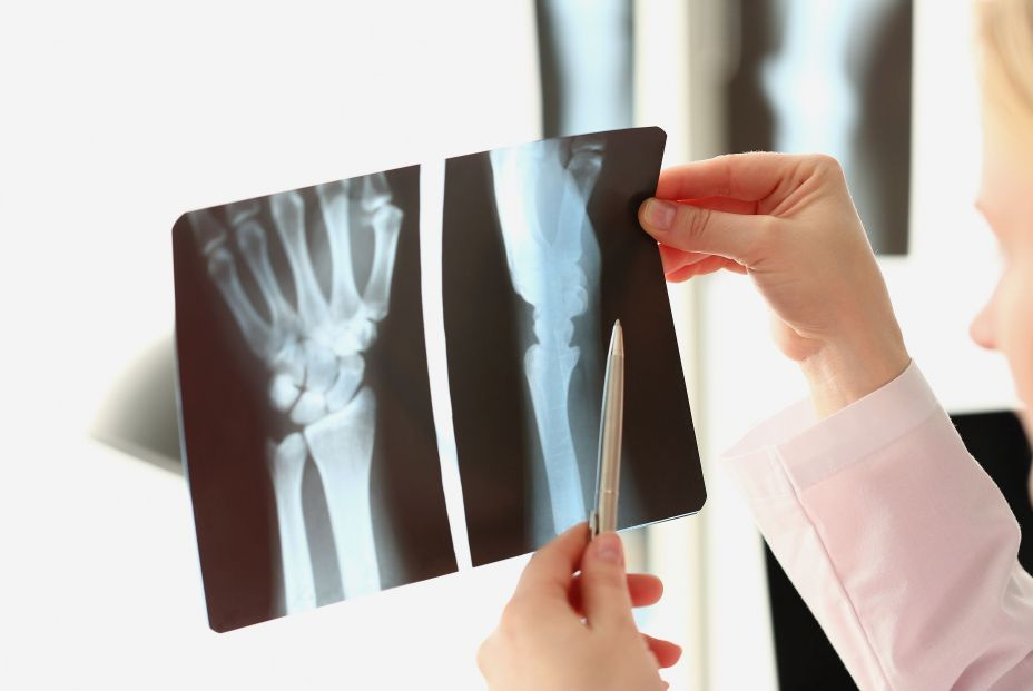 Desarrollan la primera técnica que combina una prueba diagnóstico y tratamiento para la artritis