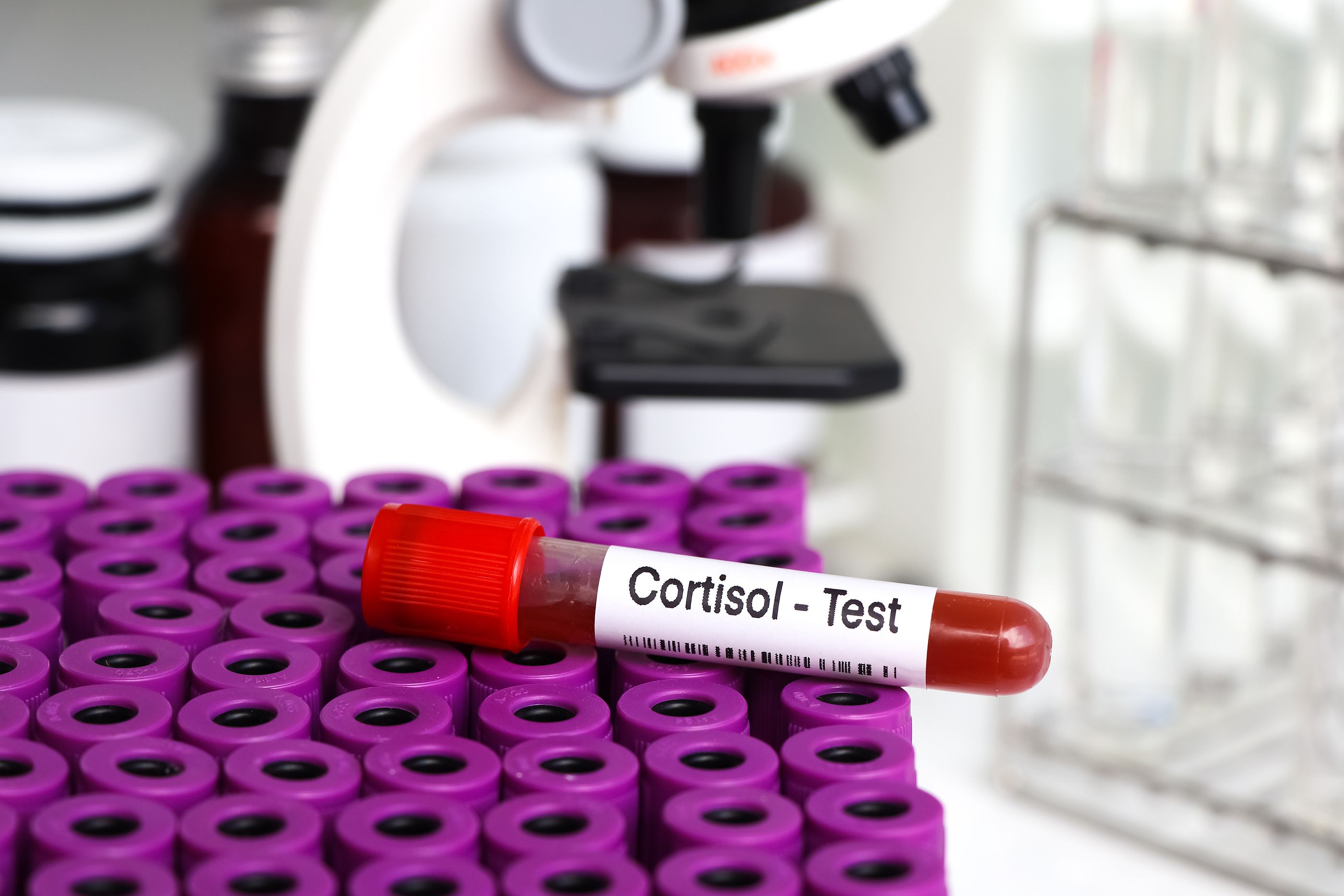 El impacto del cortisol en nuestra salud