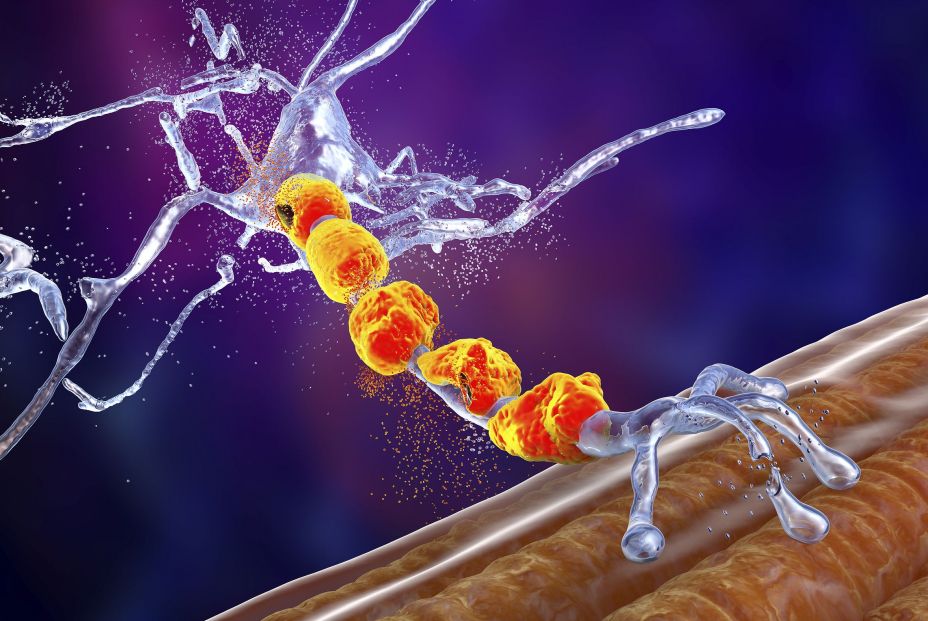 bigstock Degradation Of Motor Neurons  420881894