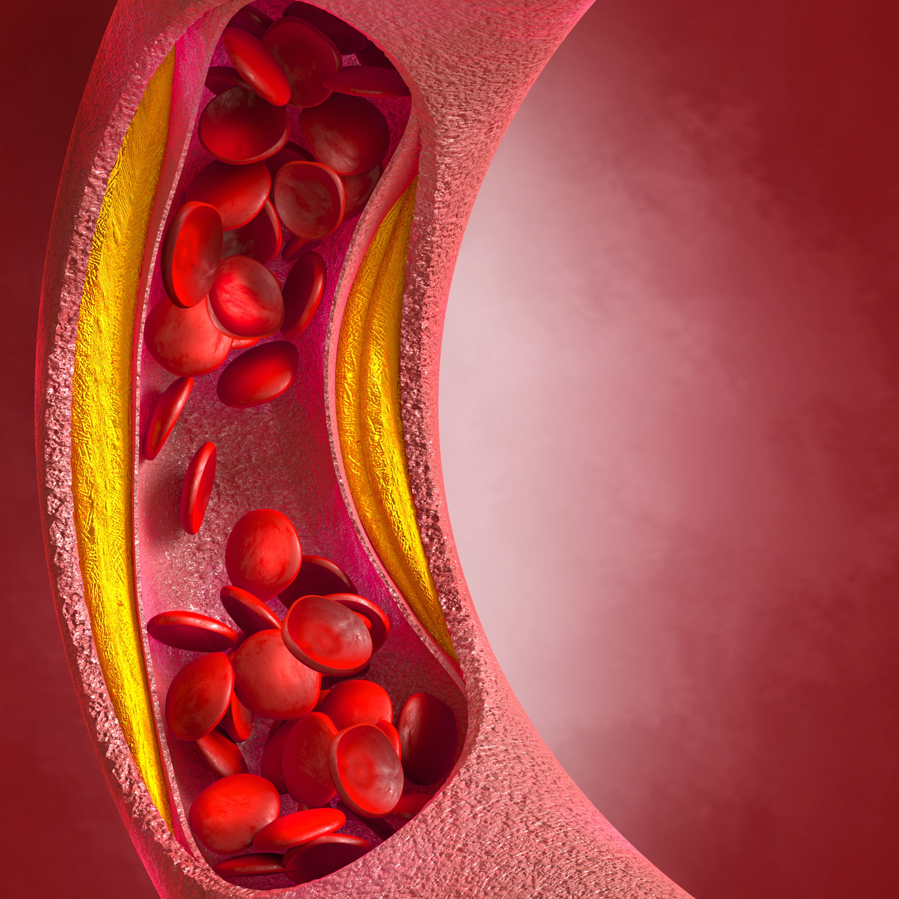 Crean un algoritmo de IA capaz de diagnosticar infartos: acierta al 99%