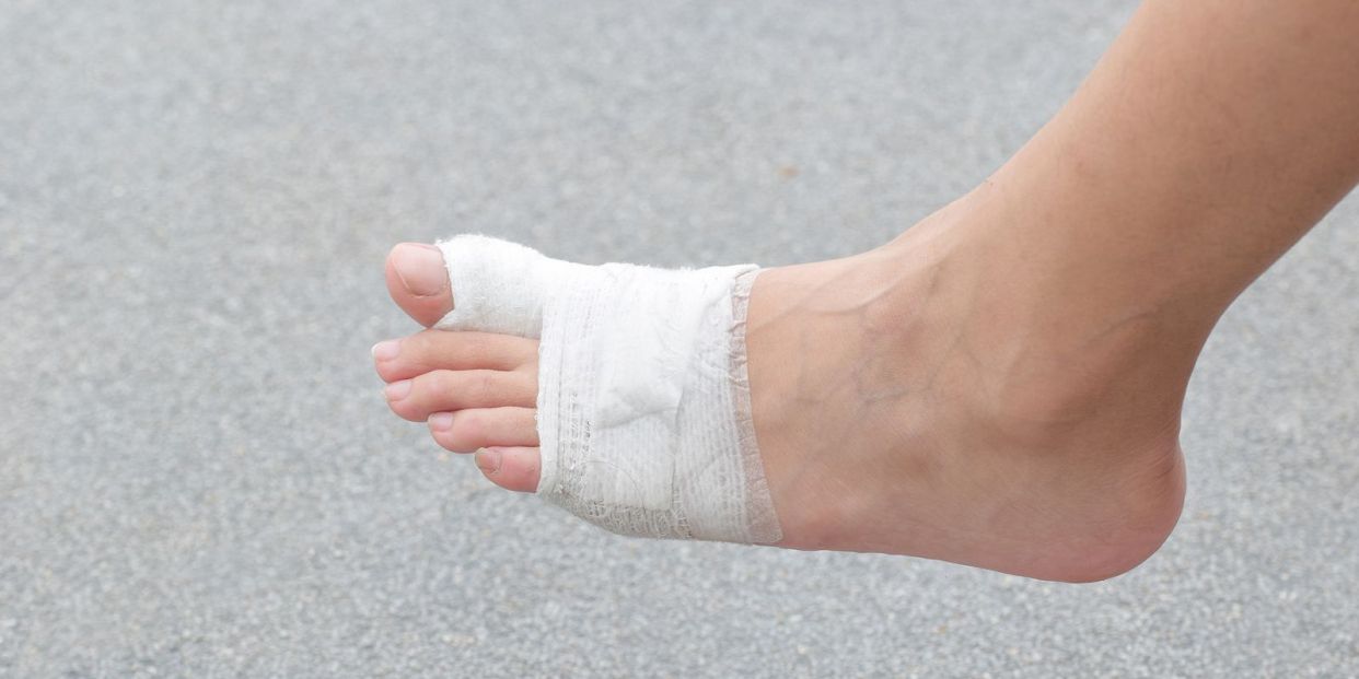 Cuidados antes una fractura de un dedo del pie