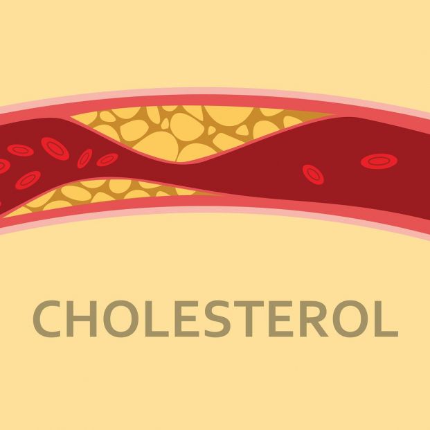 Colesterol y ateroesclerosis