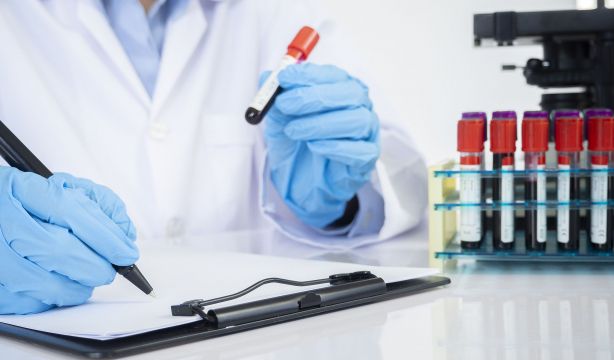 Un nuevo análisis de sangre podría detectar el párkinson antes del daño neurológico. Foto: Bigstock