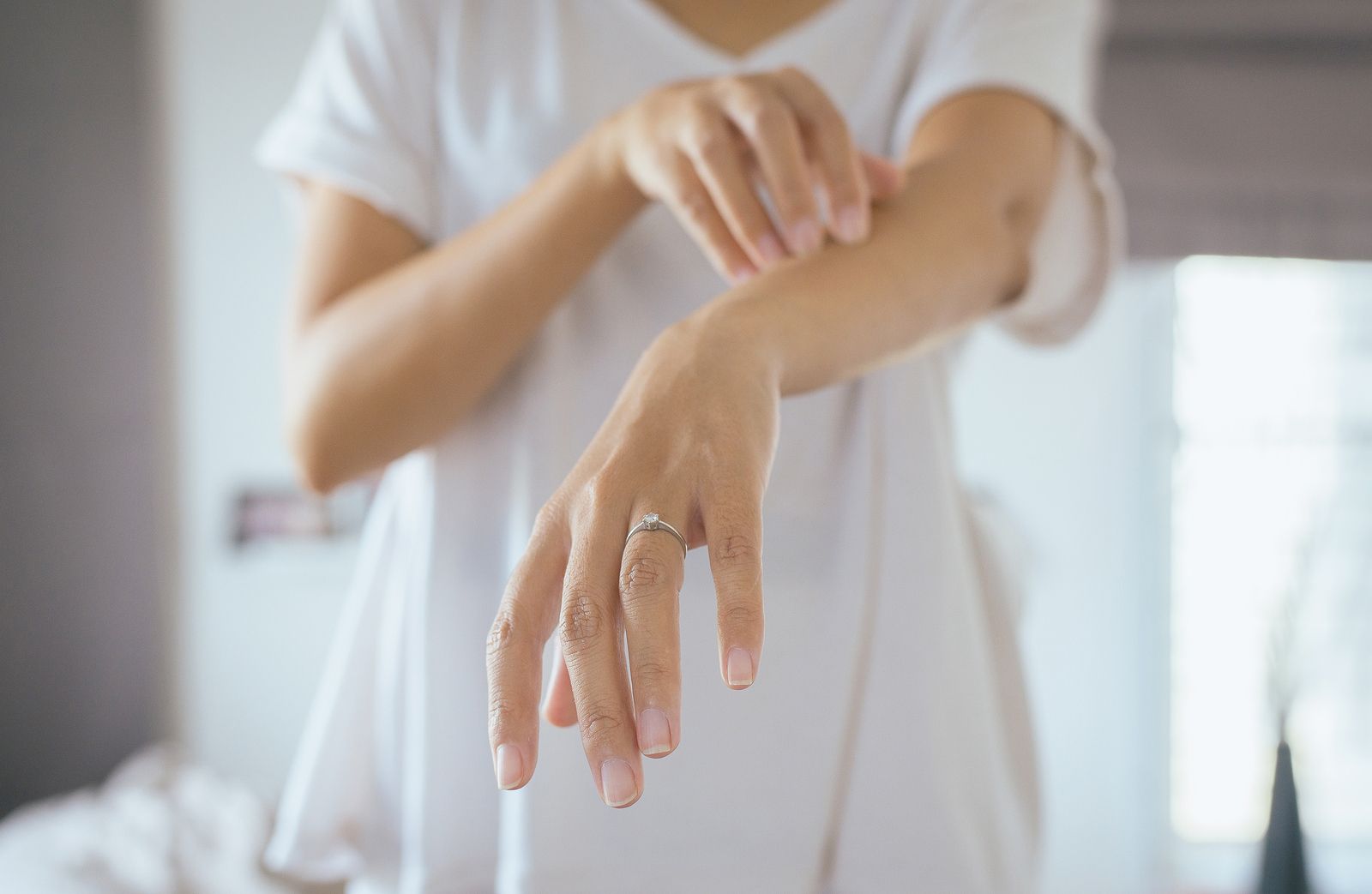 Consejos para paliar los síntomas de la dermatitis atópica (Bigstock)