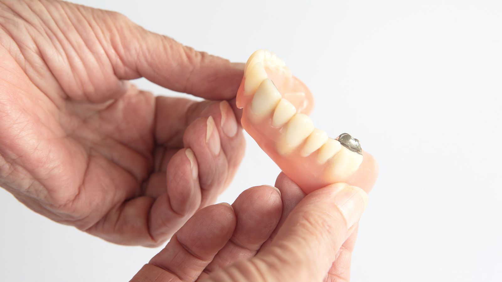 ¿Por qué las personas mayores pierden sus dientes? Una afección llamada edentulismo
