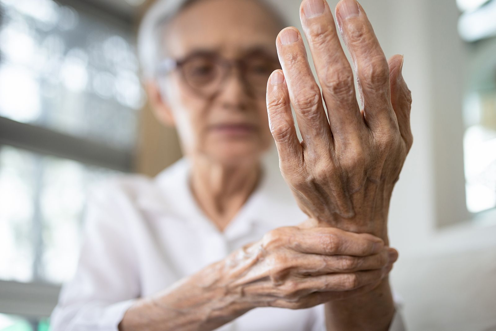 Un medicamento asequible y existente podría ayudar a las personas con artrosis dolorosa en la mano