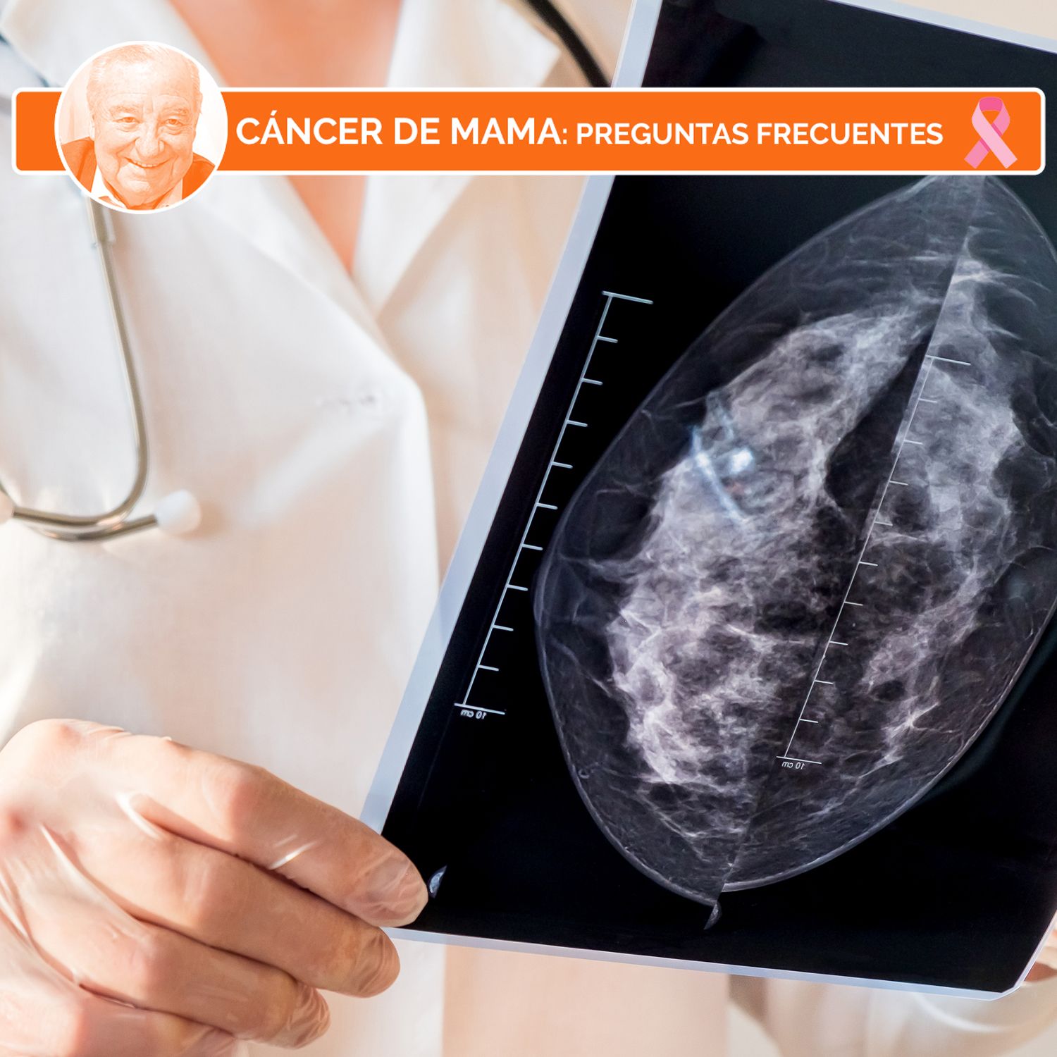 Guía del cáncer de mama: todas las preguntas y respuestas sobre la enfermedad