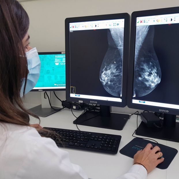 Las comunidades siguen sin aumentar la edad en cribados de cáncer de mama: "La detección es clave". Foto: Europa Press