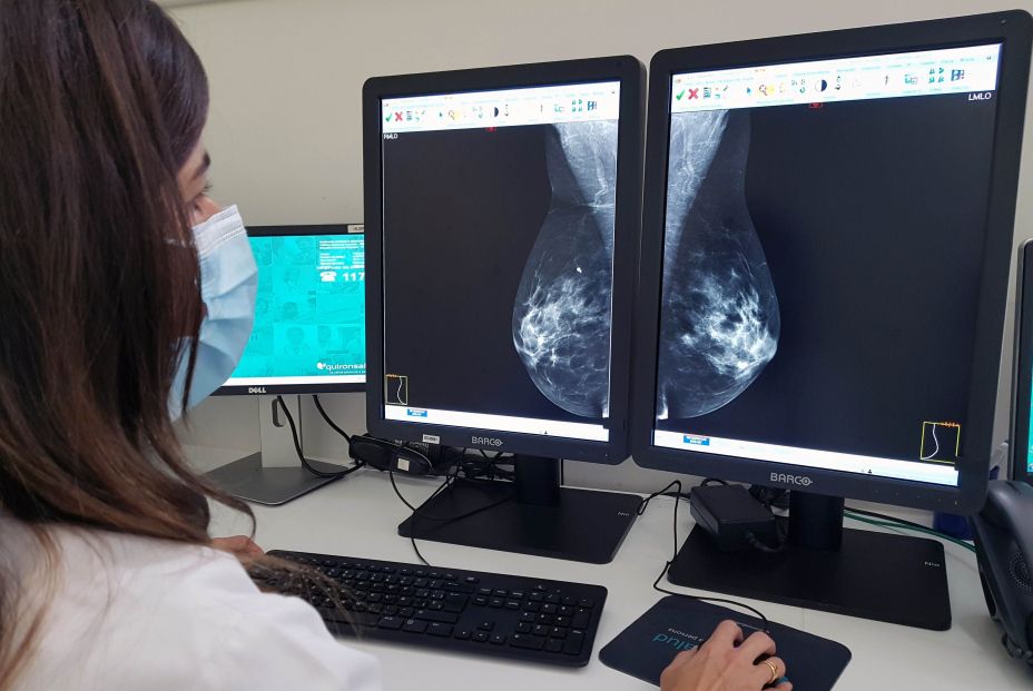 Las comunidades siguen sin aumentar la edad en cribados de cáncer de mama: "La detección es clave". Foto: Europa Press Las comunidades siguen sin aumentar la edad en cribados de cáncer de mama: "La detección es clave". Foto: Europa Press