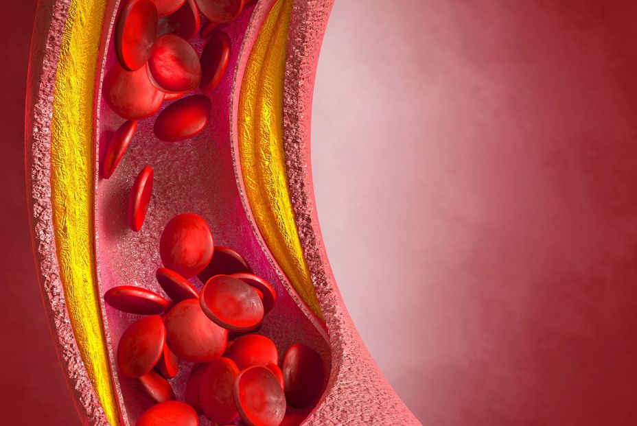 Sanidad financia el nuevo tratamiento contra el colesterol: Leqvio